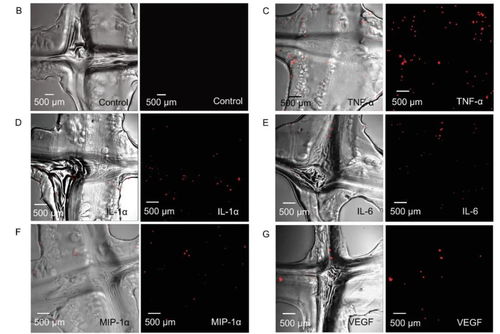 創(chuàng)新3D打印網(wǎng)狀生物材料支架 軟組織修復與炎癥調節(jié)的新希望